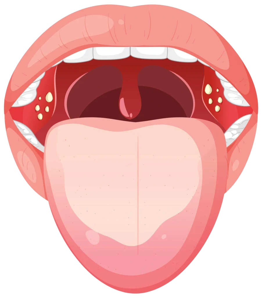 Minimally Invasive Surgery Techniques
