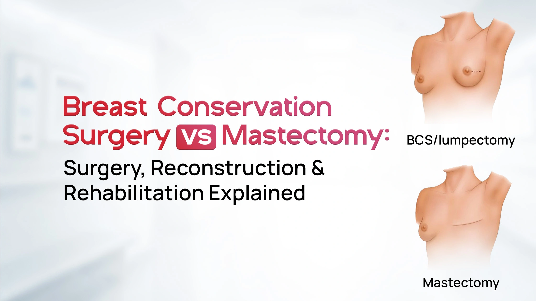 Breast Conservation Surgery vs Mastectomy: Which Is Right for You?