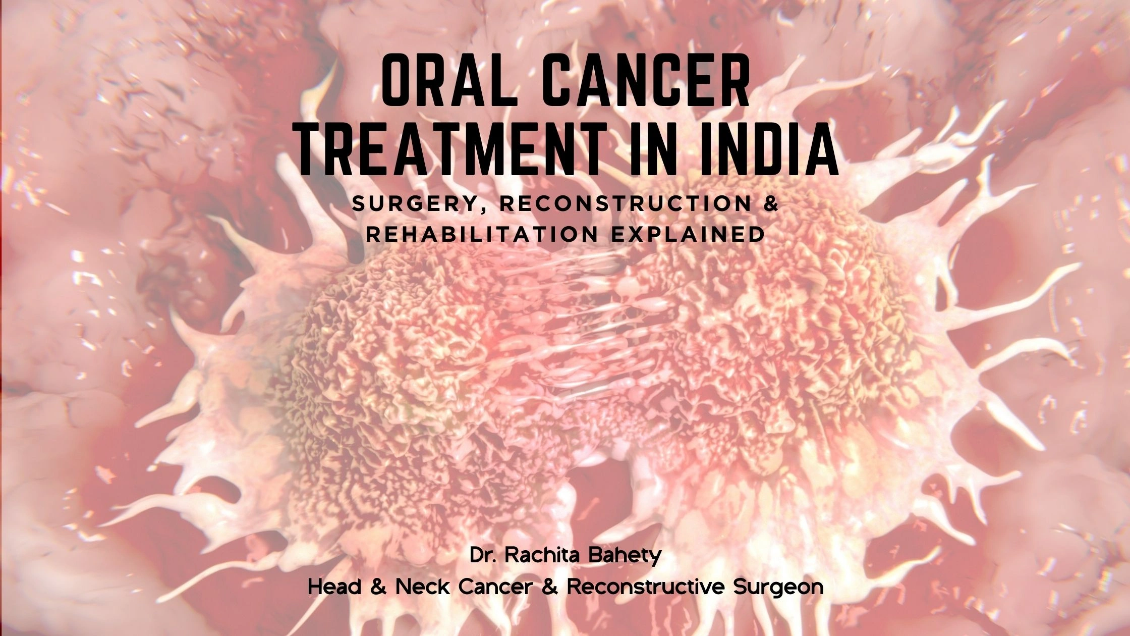 Oral Cancer Treatment in India: Surgery, Reconstruction & Rehabilitation Explained