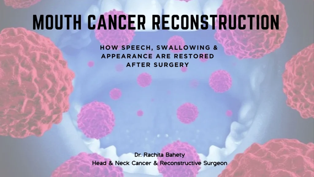 Mouth Cancer Reconstruction: How Speech, Swallowing & Appearance Are Restored After Surgery