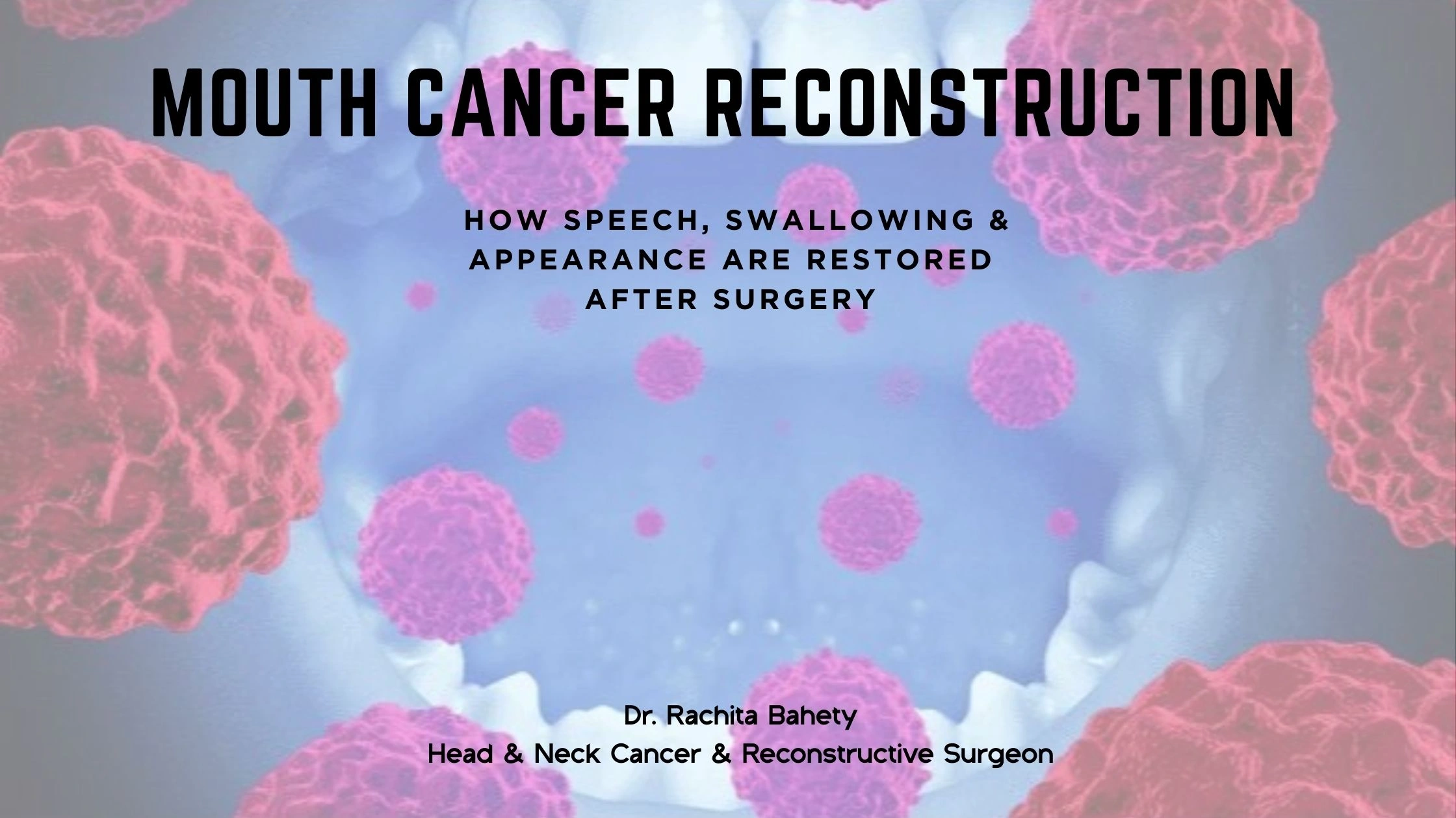 Mouth Cancer Reconstruction: How Speech, Swallowing & Appearance Are Restored After Surgery