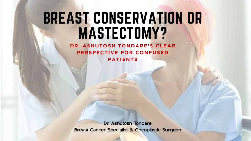 Mastectomy